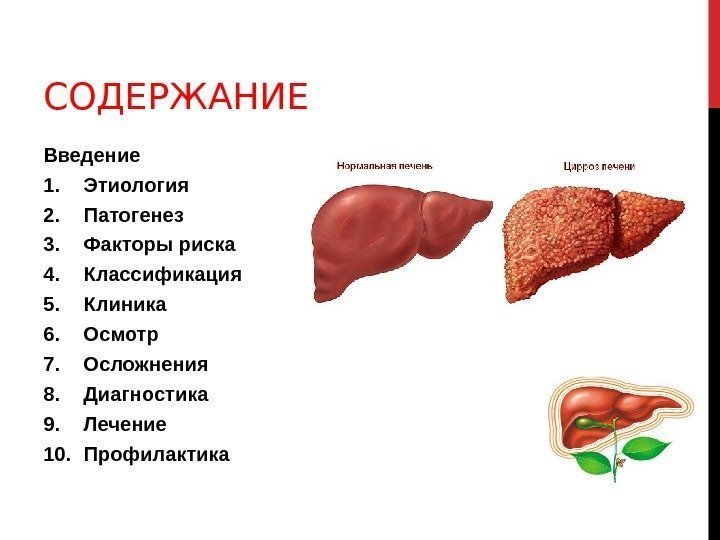 СОДЕРЖАНИЕ Введение 1. Этиология 2. Патогенез 3. Факторы риска 4. Классификация 5. Клиника 6.