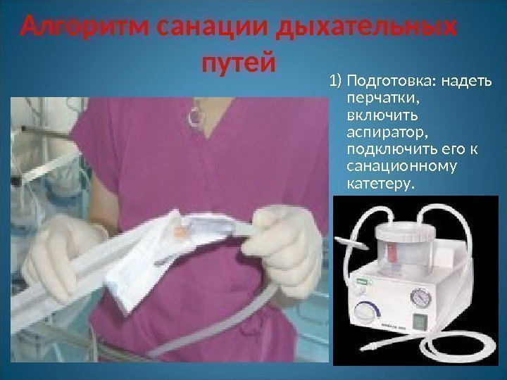 Алгоритм санации дыхательных путей 1) Подготовка: надеть перчатки,  включить аспиратор,  подключить его
