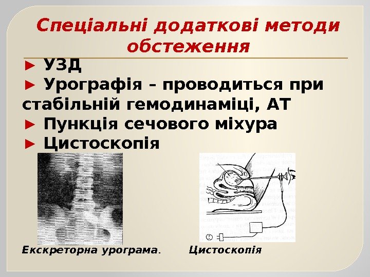 Спеціальні додаткові методи обстеження ► УЗД ► Урографія – проводиться при стабільній гемодинаміці, АТ