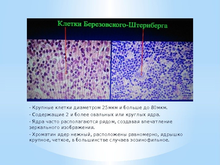 - Крупные клетки диаметром 25 мкм и больше до 80 мкм. - Содержащие 2