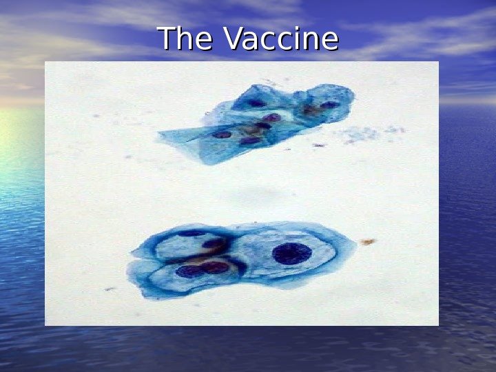 The Vaccine 