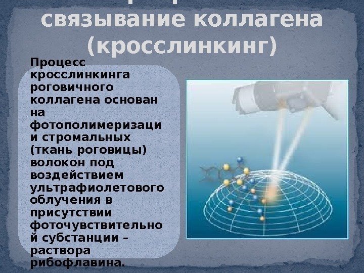 Перекрестное связывание коллагена (кросслинкинг) Процесс кросслинкинга роговичного коллагена основан на фотополимеризаци и стромальных (ткань