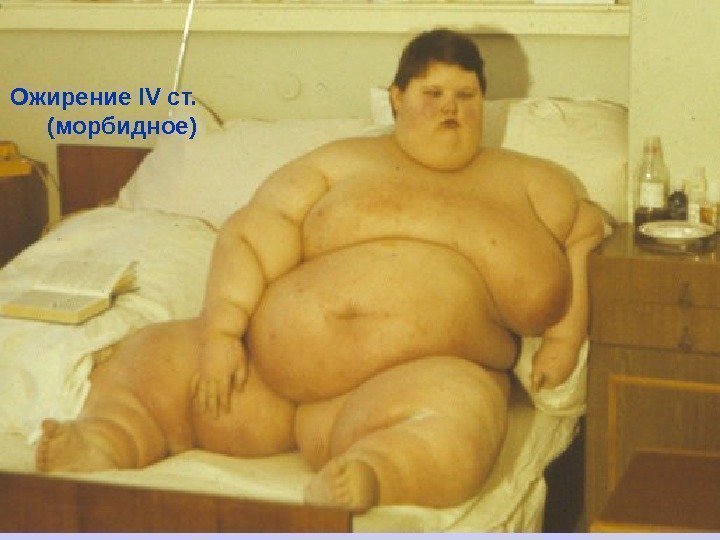   Ожирение IV ст.  ( морбидное) 