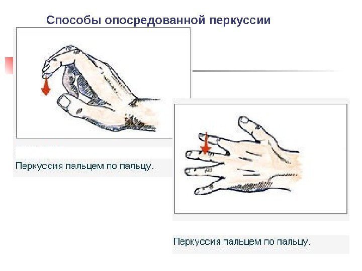 Способы опосредованной перкуссии 