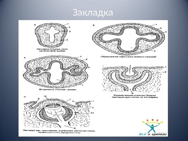 Закладка 