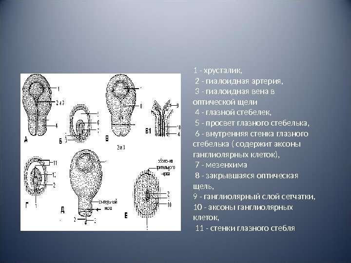 1 - хрусталик,  2 - гиалоидная артерия,  3 - гиалоидная вена в