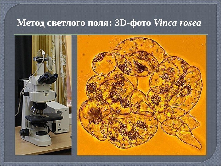 Метод светлого поля:  3 D- фото Vinca rosea 