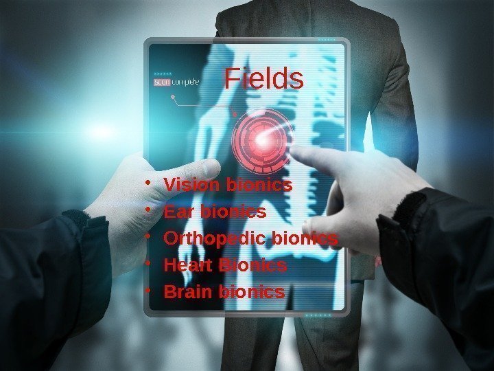 Fields • Vision bionics • Ear bionics • Orthopedic bionics • Heart Bionics •