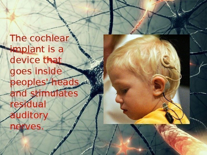   The cochlear implant is a device that goes inside peoples' heads and