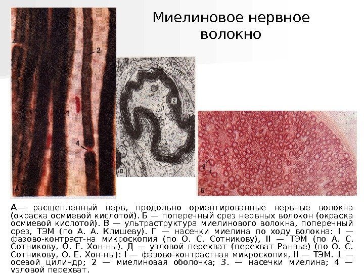   А — расщепленный нерв,  продольно ориентированные нервные волокна (окраска осмиевой кислотой).