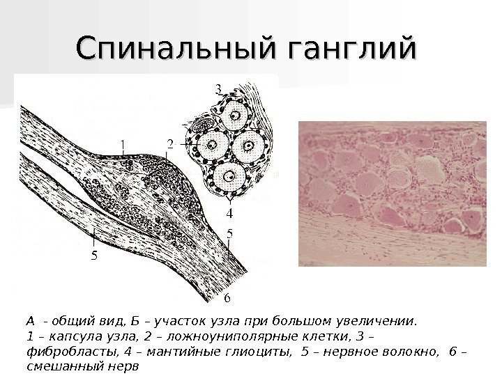   Спинальный ганглий А - общий вид, Б – участок узла при большом