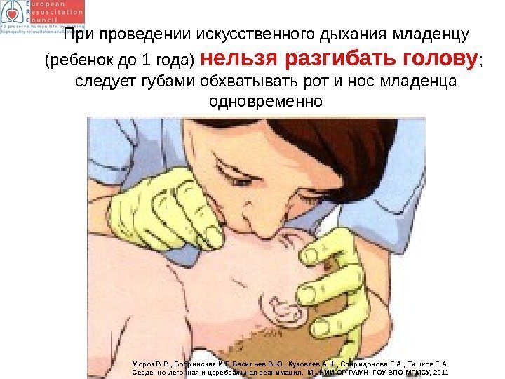 При проведении искусственного дыхания младенцу (ребенок до 1 года) нельзя разгибать голову ; 