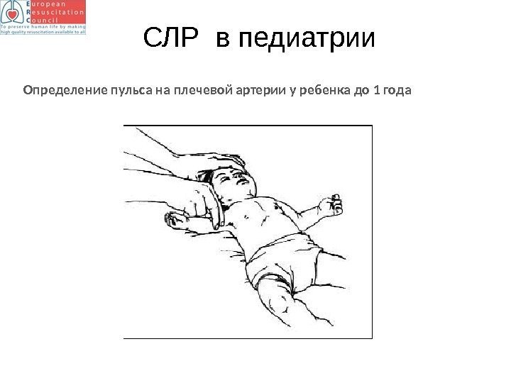 Определение пульса на плечевой артерии у ребенка до 1 года СЛР в педиатрии 