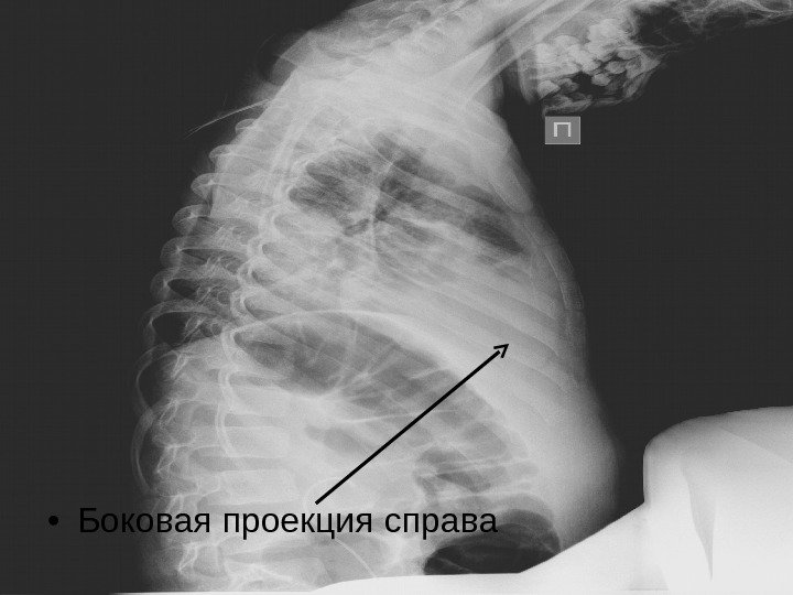  • Боковая проекция справа 