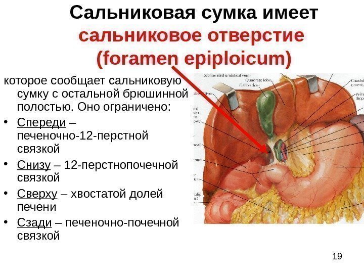19 Сальниковая сумка имеет сальниковое отверстие ( foramen epiploicum ) которое сообщает сальниковую сумку