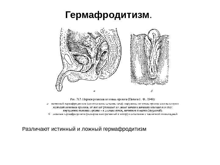 Гермафродитизм.  Различают истинный и ложный гермафродитизм 