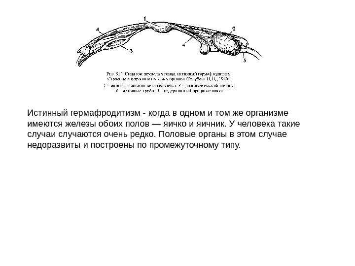 Истинный гермафродитизм - когда в одном и том же организме имеются железы обоих полов