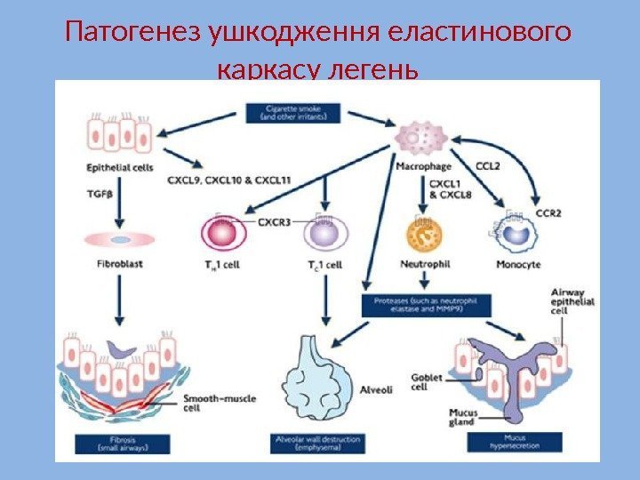 Патогенез ушкодження еластинового каркасу легень 