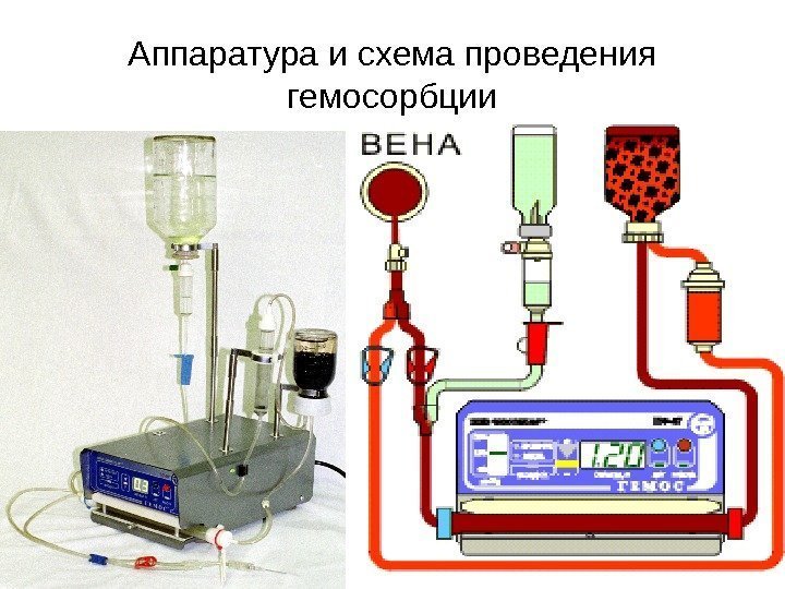 Аппаратура и схема проведения гемосорбции 