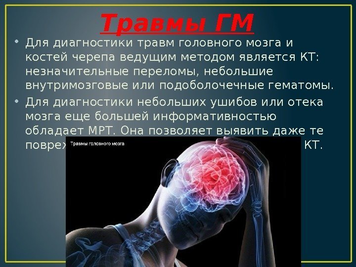 Травмы ГМ • Для диагностики травм головного мозга и костей черепа ведущим методом является