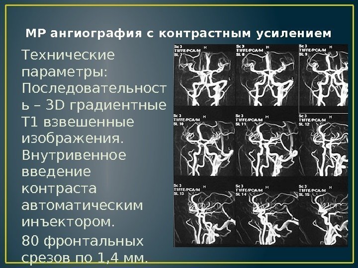 МР ангиография с контрастным усилением Технические параметры: Последовательност ь – 3 D градиентные Т