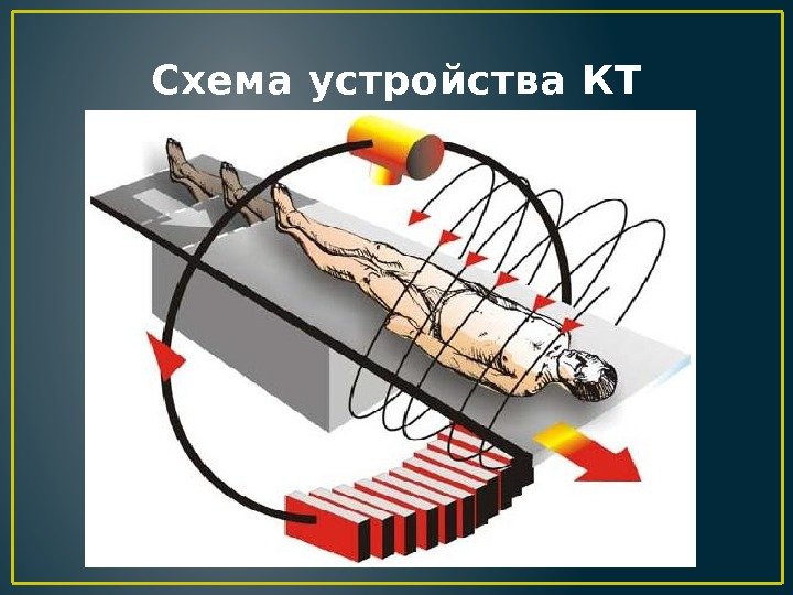 Схема устройства КТ 
