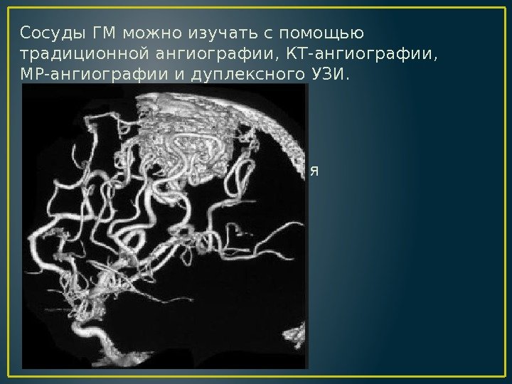 Сосуды ГМ можно изучать с помощью традиционной ангиографии, КТ-ангиографии,  MP-ангиографии и дуплексного УЗИ.