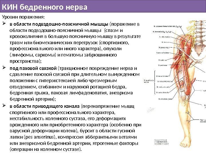 КИН бедренного нерва Уровни поражения:  в области подвздошно-поясничной мышцы (поражение в области подвздошно-поясничной