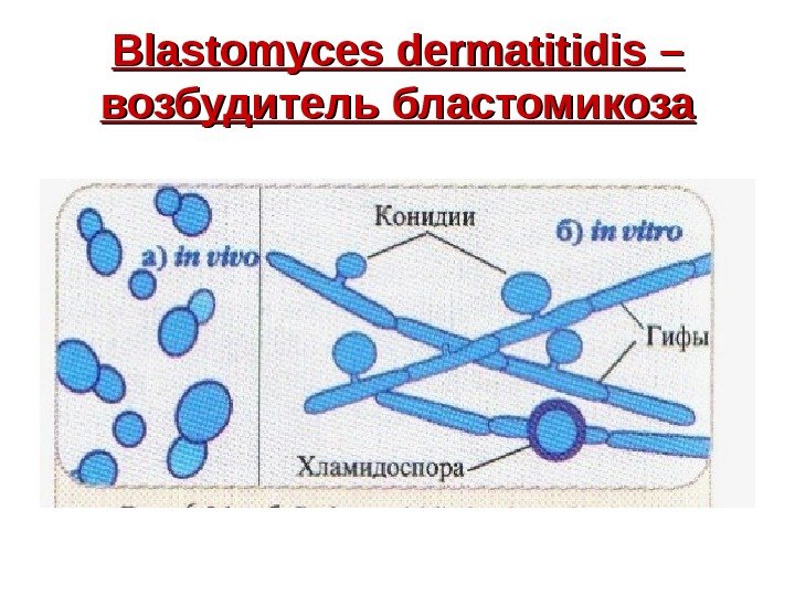   Blastomyces dermatitidis – – возбудитель бластомикоза 