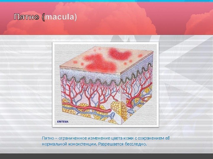 Пятно – ограниченное изменение цвета кожи с сохранением её  нормальной консистенции.  Разрешается