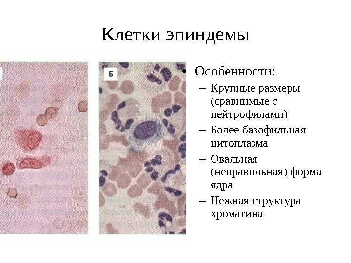 Клетки эпиндемы • Особенности: – Крупные размеры (сравнимые с нейтрофилами) – Более базофильная цитоплазма
