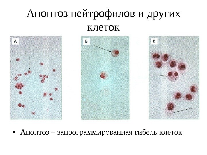 Апоптоз нейтрофилов и других клеток • Апоптоз – запрограммированная гибель клеток 