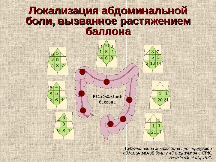   Локализация абдоминальной боли, вызванное растяжением баллона Субъективная локализация провоцируемой абдоминальной боли у