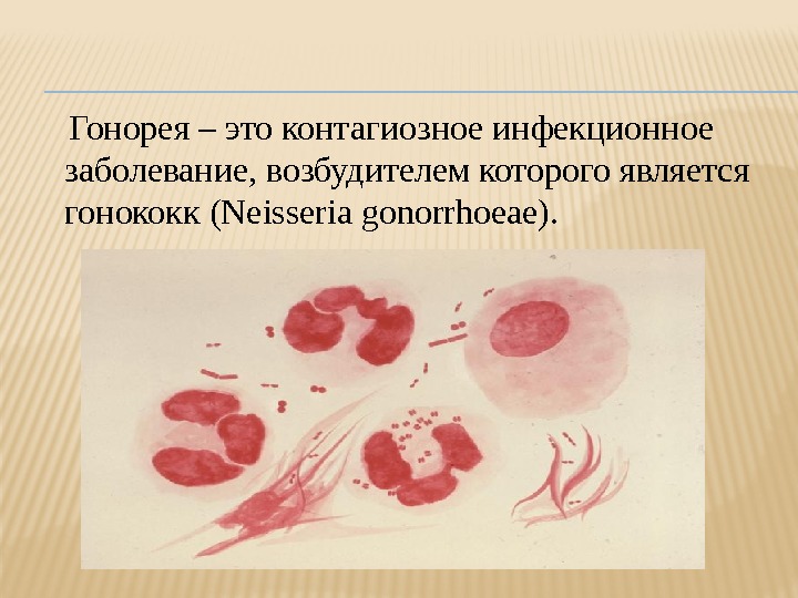   Гонорея – это контагиозное инфекционное заболевание, возбудителем которого является гонококк (Neisseria gonorrhoeae).