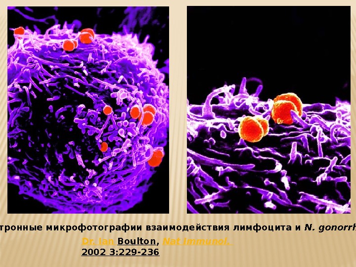  Электронные микрофотографии взаимодействия лимфоцита и N. gonorrhoeae Dr. Ian Boulton ,  Nat
