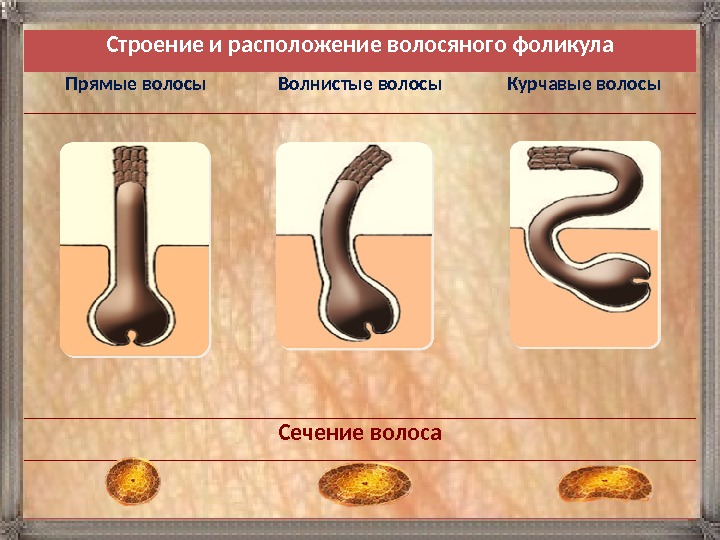 Строение и расположение волосяного фоликула Прямые волосы Волнистые волосы Курчавые волосы   