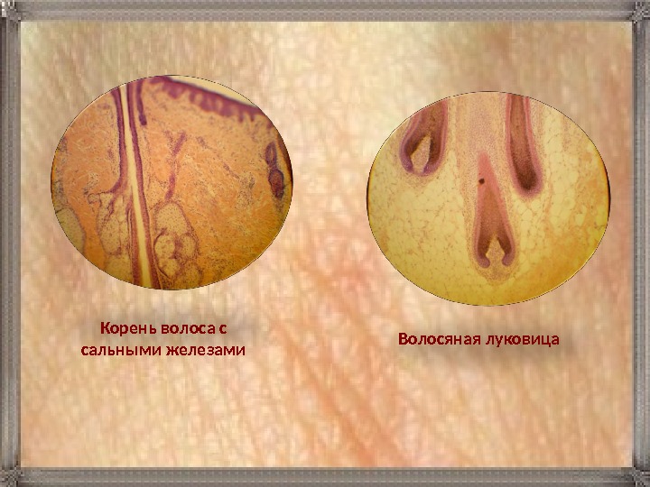 Волосяная луковица. Корень волоса с сальными железами 