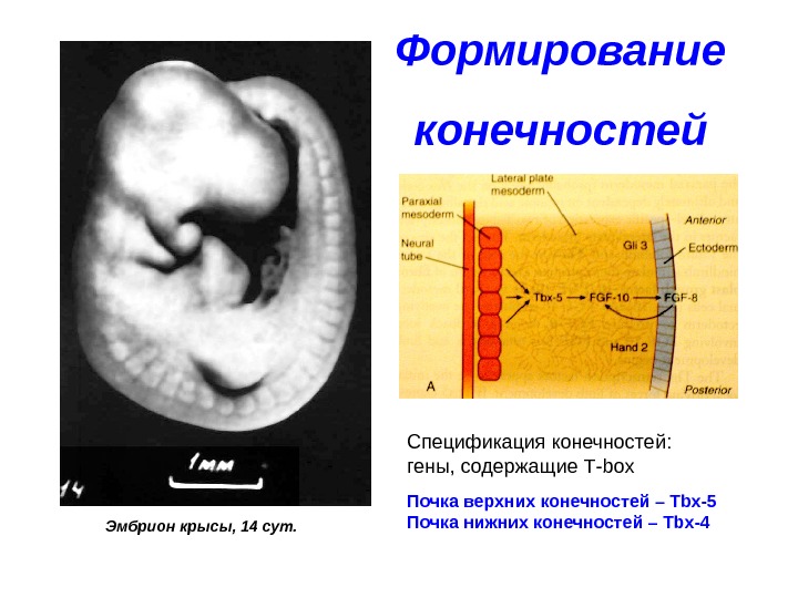 Формирование  конечностей Эмбрион крысы, 14 сут. Спецификация конечностей:  гены, содержащие Т- box