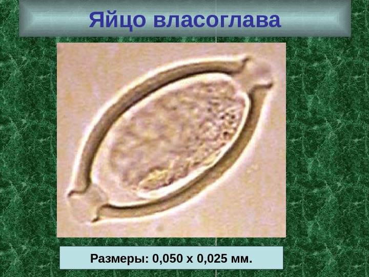 Яйцо власоглава Размеры: 0, 050 х 0, 025 мм. 