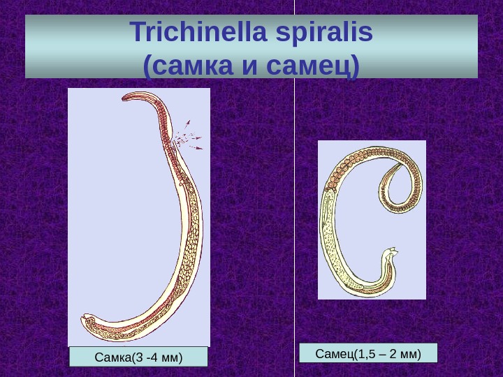 Trichinella spiralis ( самка и самец) Самка (3 -4 мм) Самец(1, 5 – 2