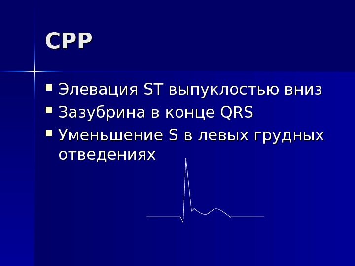   СРРСРР Элевация ST ST выпуклостью вниз Зазубрина в конце QRSQRS Уменьшение S