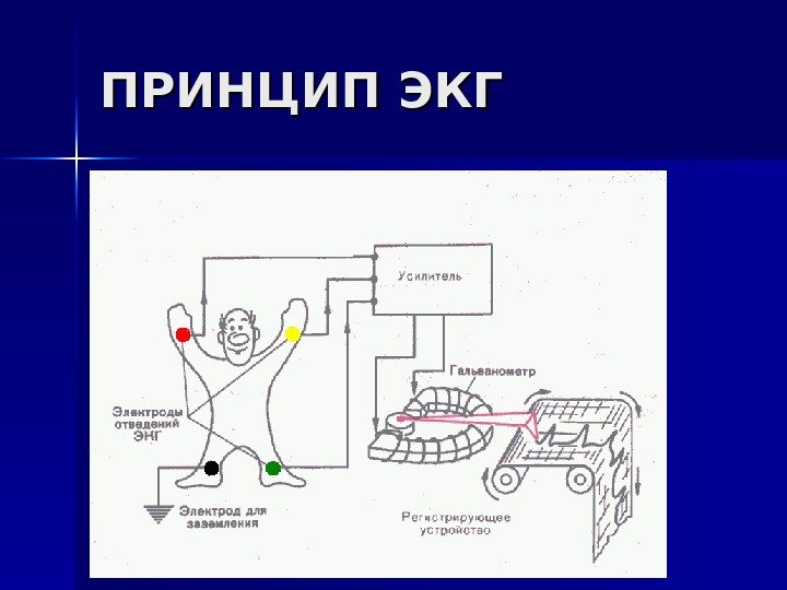   ПРИНЦИП ЭКГ 