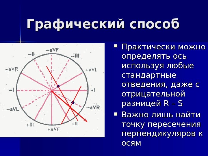   Графический способ Практически можно определять ось используя любые стандартные отведения, даже с