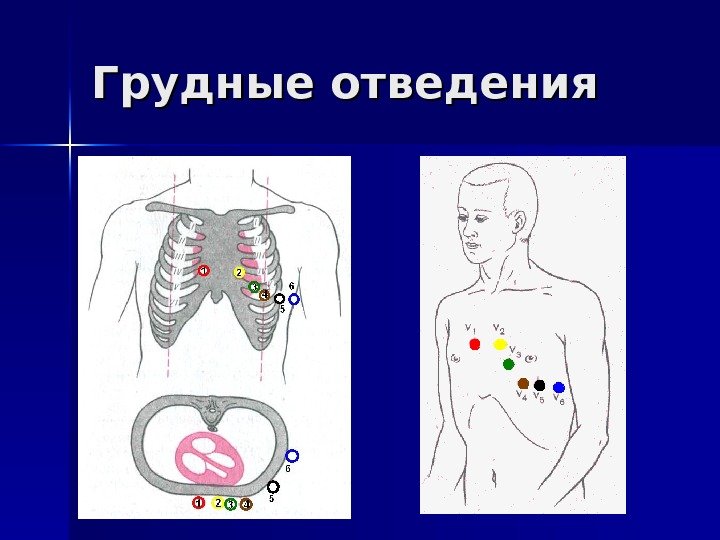   Грудные отведения 