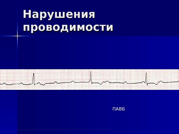   Нарушения проводимости ПАВБ 