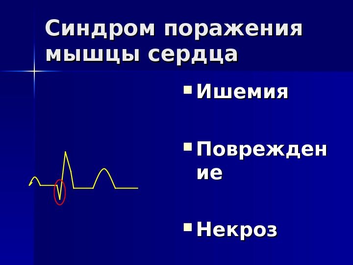   Ишемия Поврежден иеие Некроз. Синдром поражения мышцы сердца 