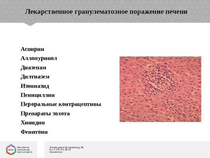 Лекарственное гранулематозное поражение печени Аспирин Аллопуринол Диазепам Дилтиазем Изониазид Пенициллин Пероральные контрацептивы Препараты золота