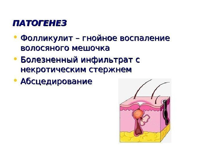   ПАТОГЕНЕЗ • Фолликулит – гнойное воспаление волосяного мешочка • Болезненный инфильтрат с