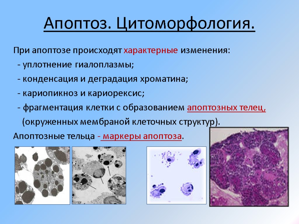 Морфологические изменения клеток. Апоптоз клетки микроскоп. Кариорексис кариолизис. Апоптозные тельца. Апоптоз конденсация хроматина.