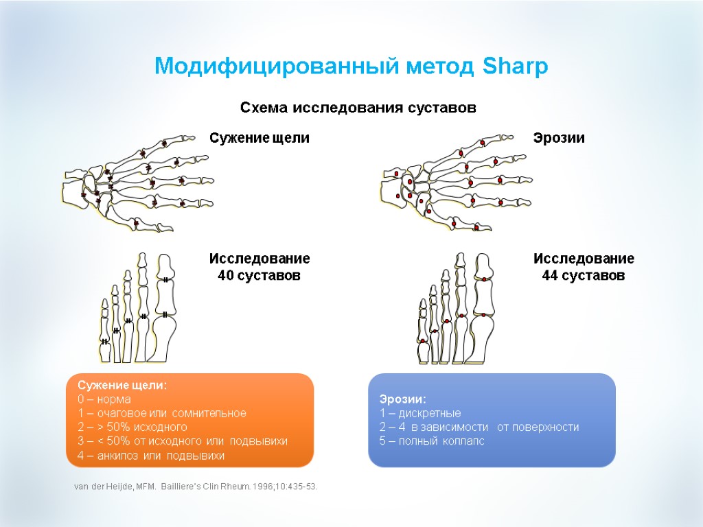 Исследование суставов